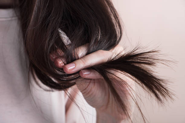 Tabaco y alopecia, ¿están relacionados? - Blog Olistic 