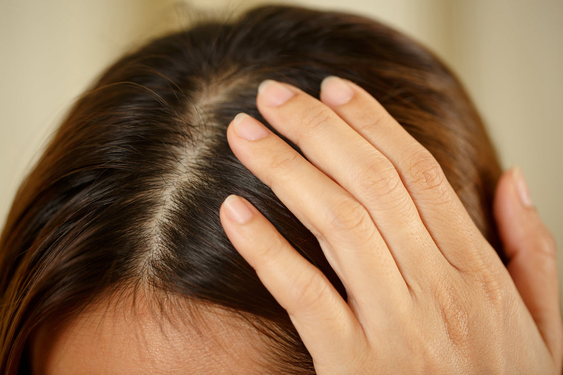 Entrate nei capelli nelle donne?
