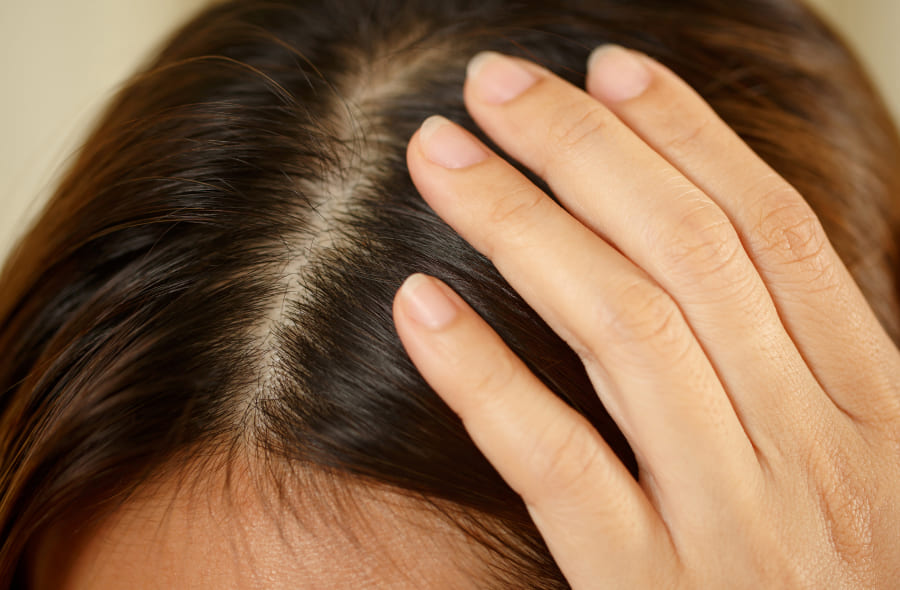 Come crescono i capelli? Scopri cosa succede sotto il cuoio capelluto