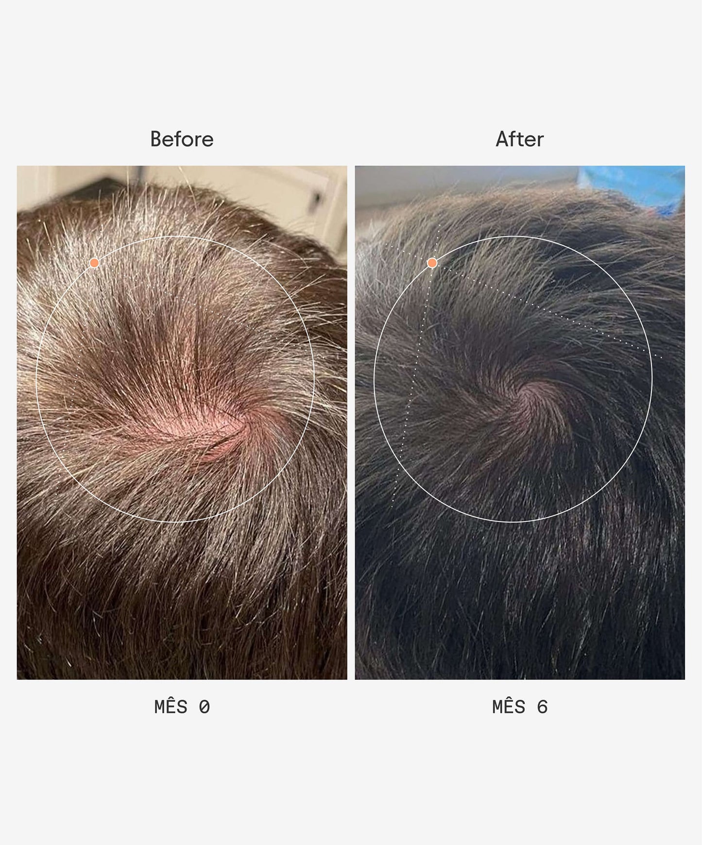 Before and After - Olistic men