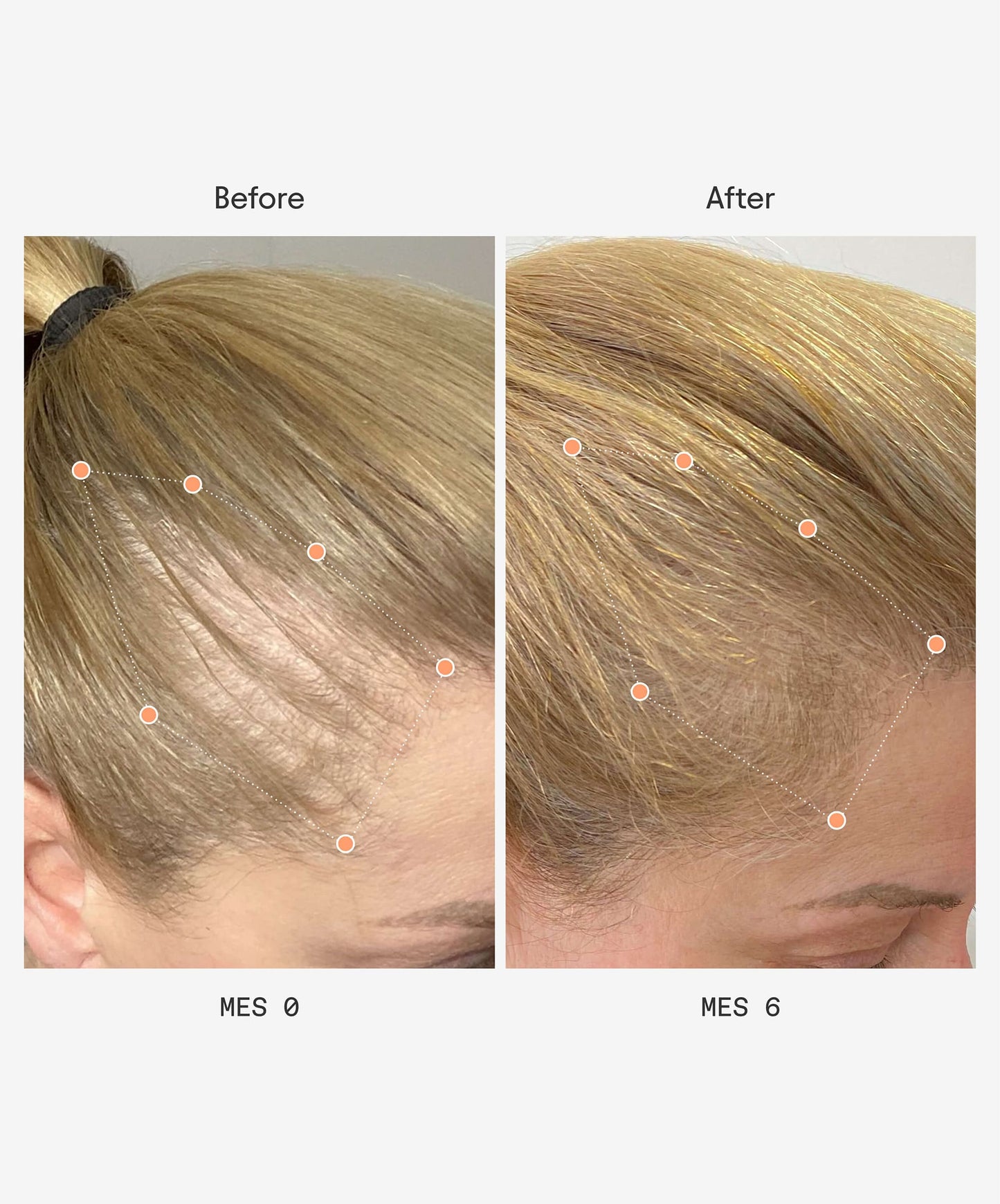 Before After - Women Next