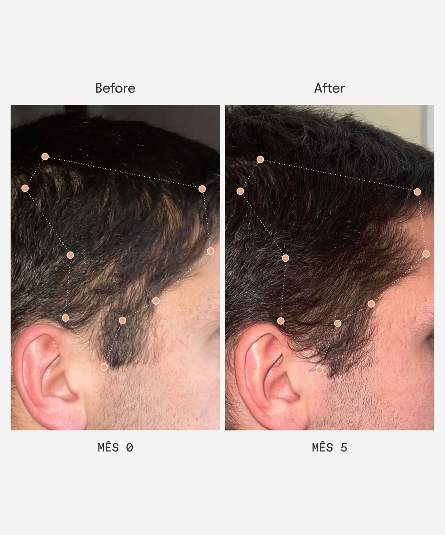 Before and After - Olistic Men