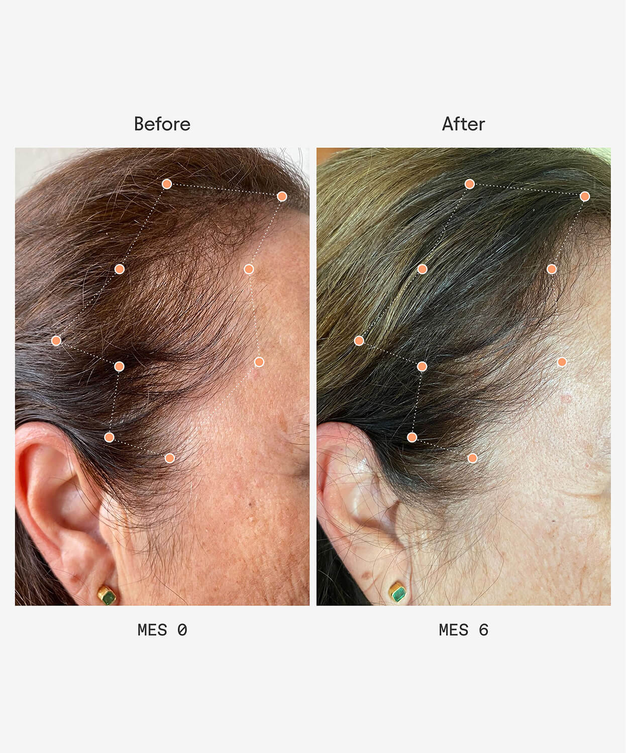 Before After - Women Next