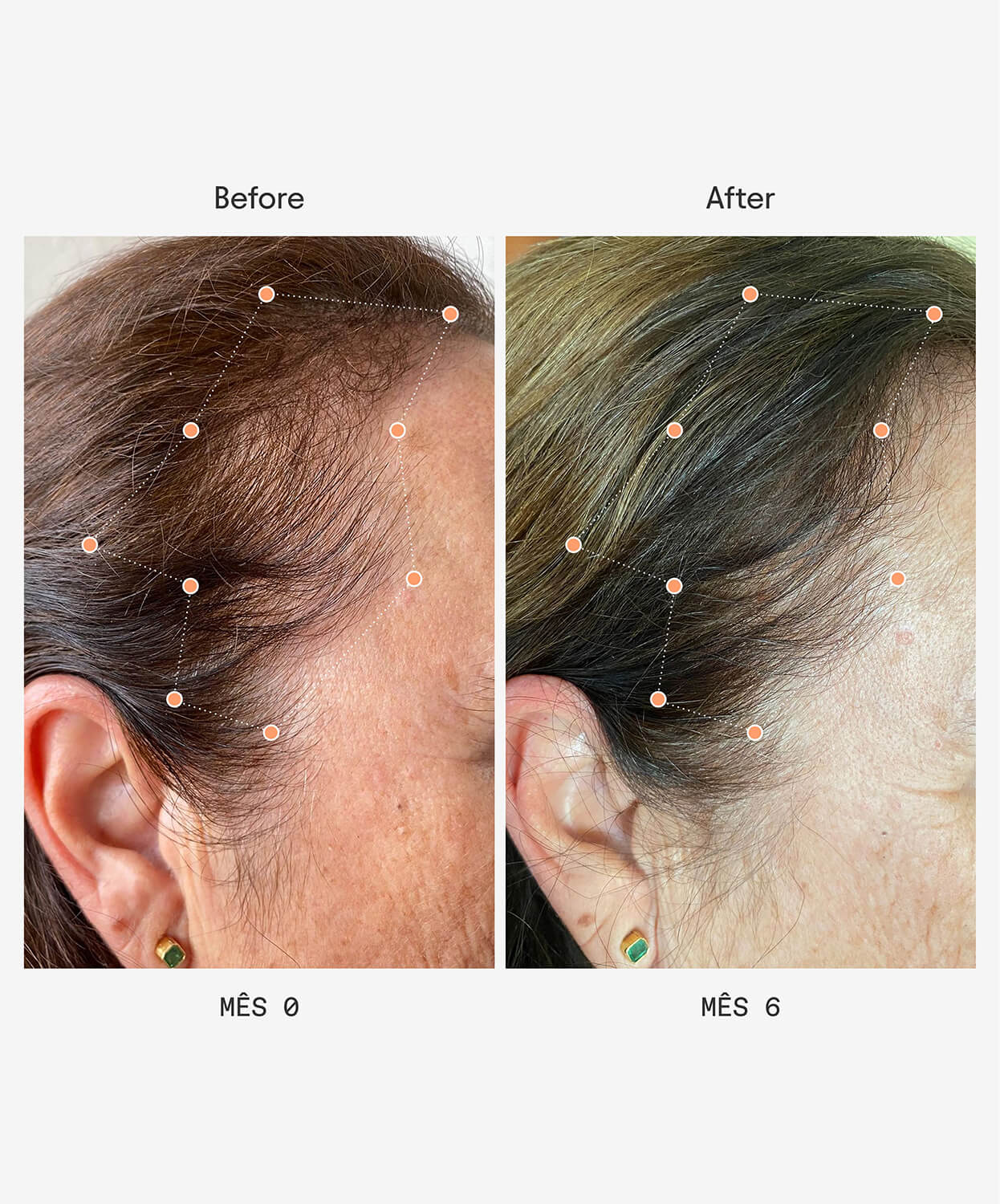 Before and after - olistic Women next