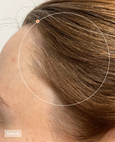 Dopo 6 mesi con Olistic Women – risultato dei capelli 2