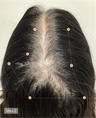 Prima del trattamento Olistic Women – caduta dei capelli 1