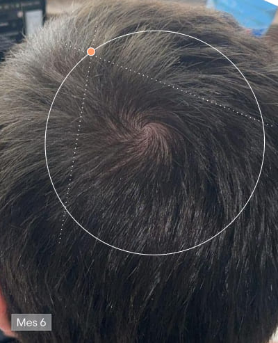 Depois de 6 meses com Olistic Men – resultado capilar
