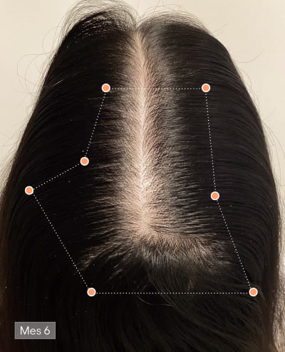 Depois de 6 meses com Olistic Women – resultado capilar