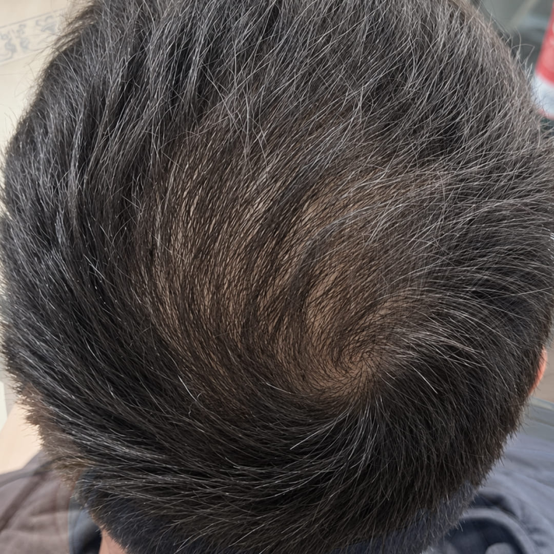 3 MESI CON OLISTIC